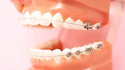 orthodontic_16