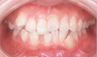 orthodontic_25