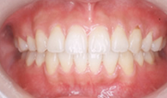 orthodontic_27